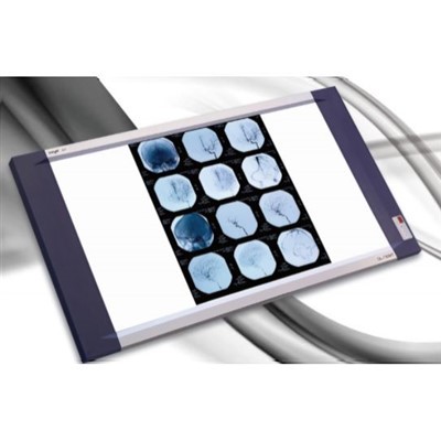 Visionneuse de films médicaux LED professionnelle